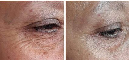 “Ça s’intègre super facilement dans ma routine”