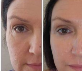 “Je me sens mieux sans maquillage…”