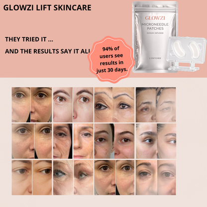 GLOWZI  LIFT -Patchs Microneedle  Contour des Yeux